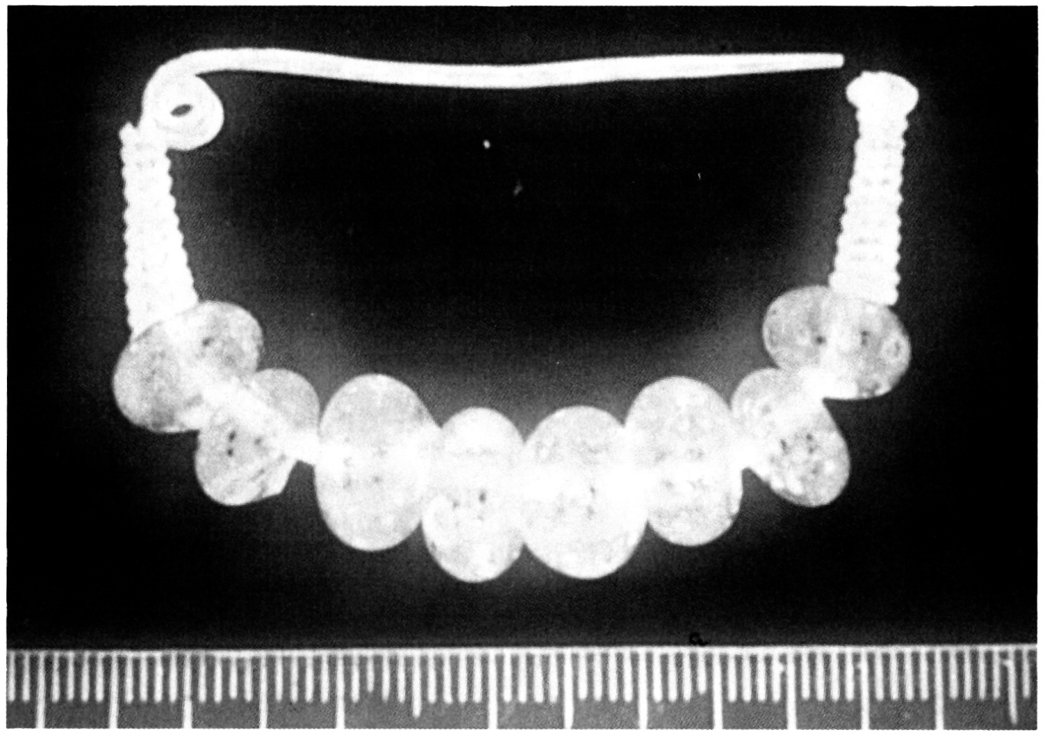 Fig. 9 - Fibula villanoviana da Castenaso (BO): elaborazione finalizzata al disegno automatico.