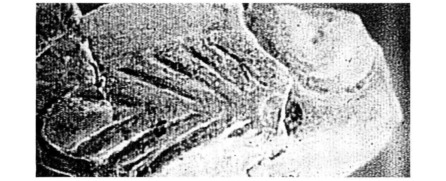 Fig. 14 - Decorazione a palmetta su brocca in bucchero pesante da Marzabotto (BO): elaborazione con filtro passa-alto.