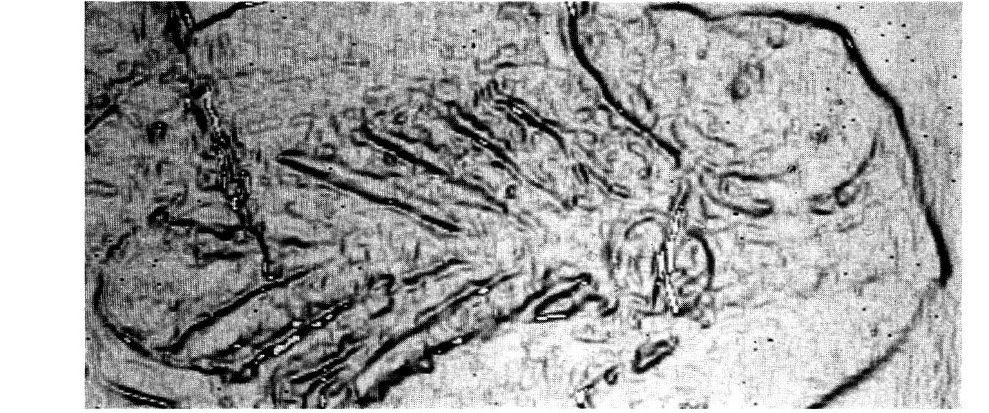 Fig. 15 - Decorazione a palmetta su bucchero: elaborazione con filtro di tipo Sobel.