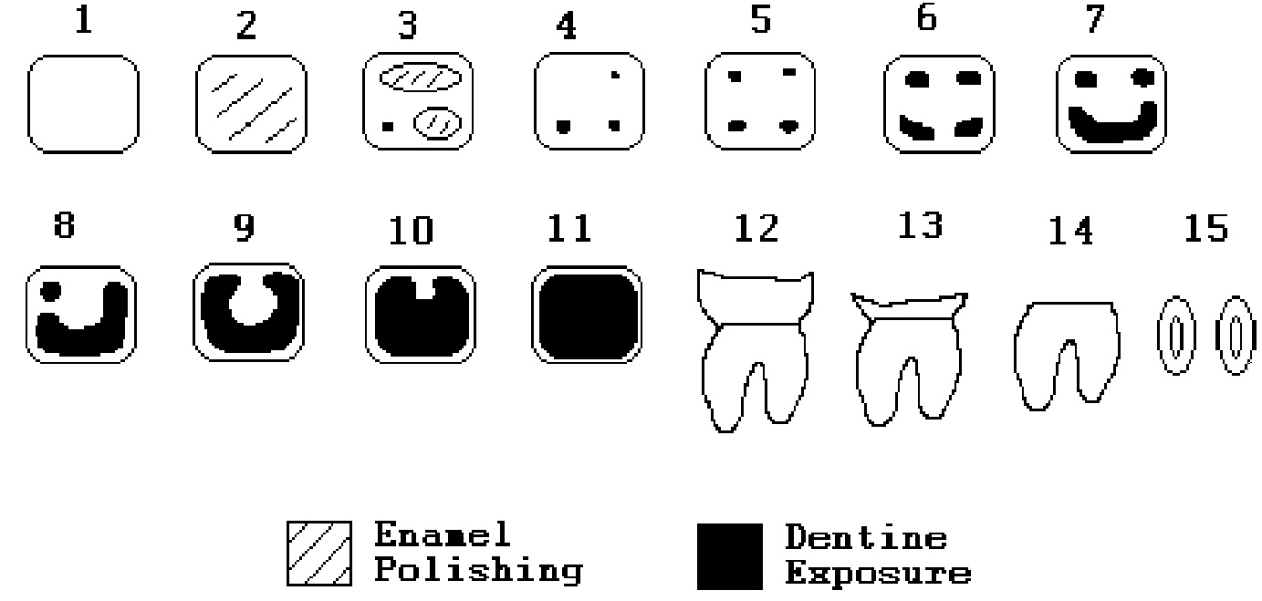 Fig. 1 – Wear thresholds used to define wear stages in this work.