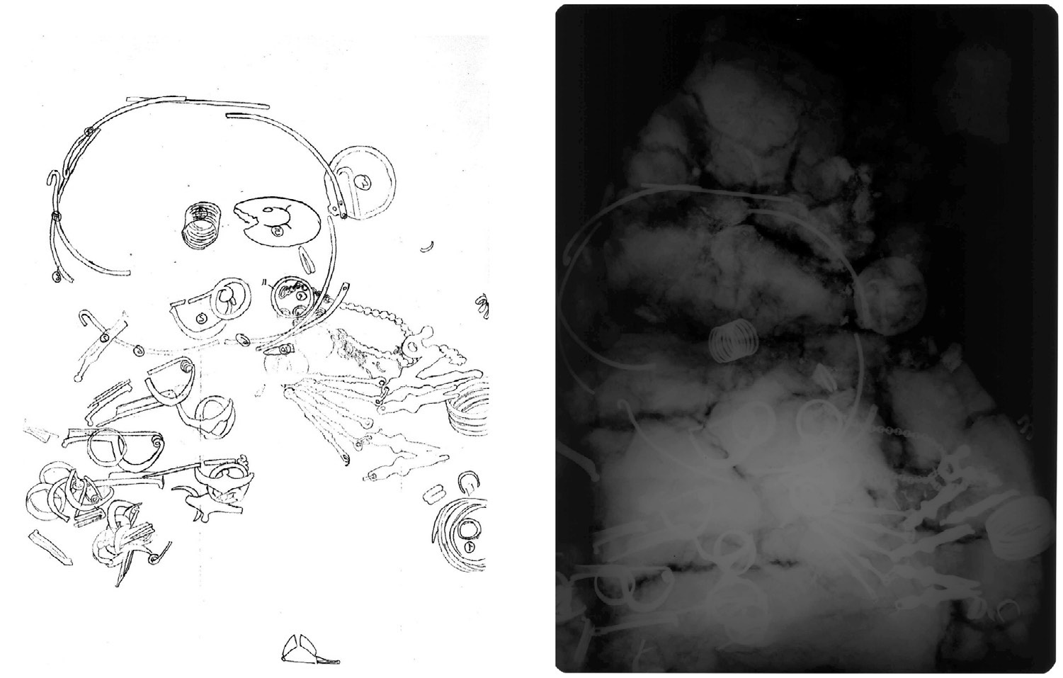 Fig. 11 – Strappo di terra da tomba: a) ricalco su lucido del corredo funerario; b) radiografia.