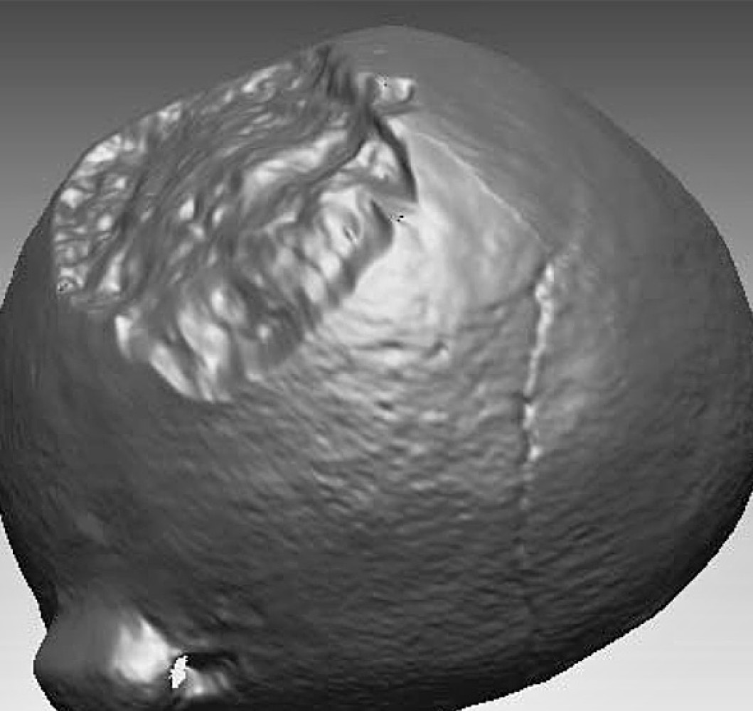 Fig. 6 – Vessel bottom showing many flaws such as cracks and the absence of clay.