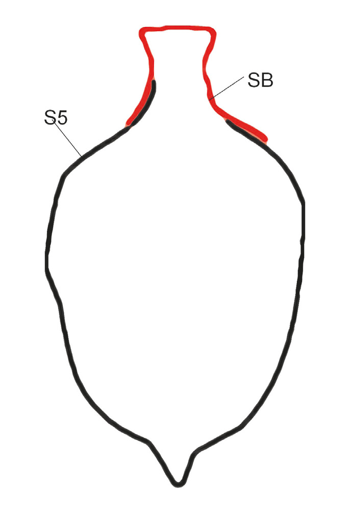 Fig. 3 – In nero la sagoma  S5, in rosso quella dell’anfora di Chiese Bruciate (SB), somiglianza maggiore indicata dai valori di r.