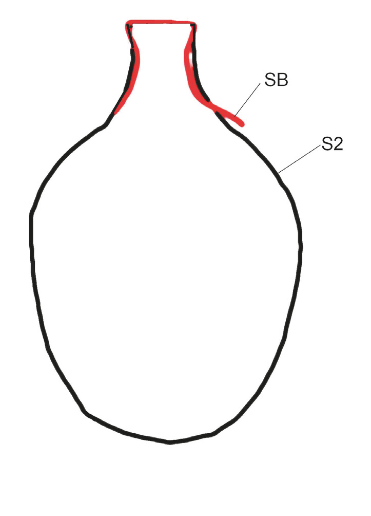 Fig. 4 – In nero la sagoma S2, in rosso quella di Chiese bruciate (SB), somiglianza maggiore indicata dal rapporto di similitudine.