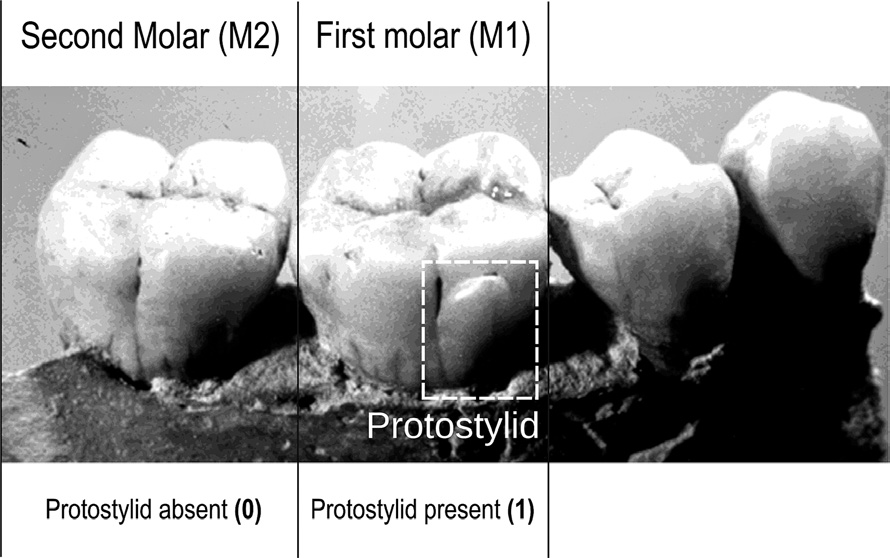 Fig. 1 – ASUDAS scoring system (Turner et al. 1991; Scott, Turner 1997) for the description of human dental morphology. Example of a dental trait scored on lower molars (the Protostylid) that can be either present (M1) or absent (M2). Our analyses were made according to 23 traits of this kind, thus giving rise to vectors having 23 binary descriptors.